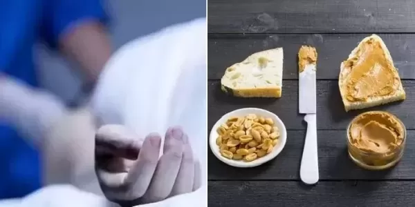 땅콩버터 먹은 파트너와 성관계한 남성, 알레르기 쇼크로 숨져