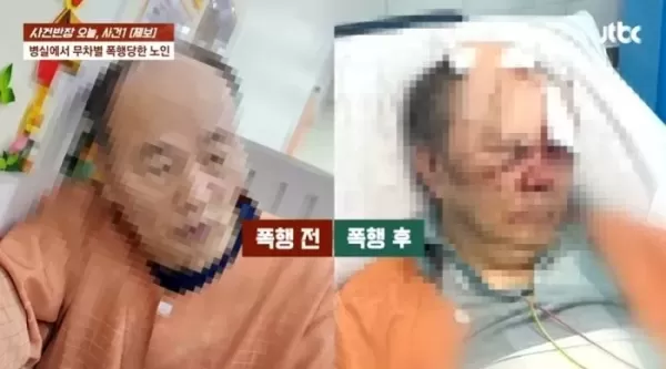 병실에서 피투성이로 발견된 80대 노인... 가족들 울분 토하게 한 30대 남성의 폭행 이유