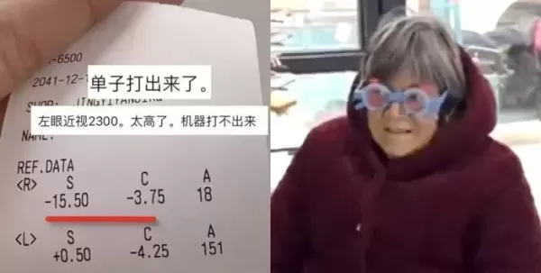 외로움에 매일 새벽까지 휴대폰 하다 시력 -15.5 초고도근시 된 70대 할머니 (영상)