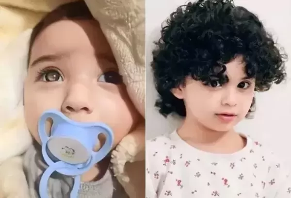 동공 반짝이던 2살 아기... 이 암 진단받고 오른쪽 눈 제거