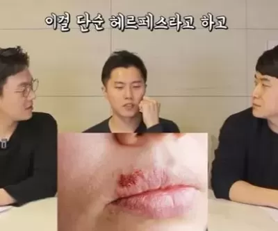 전 세계 38억명 감염시키고 완치도 안 되던 헤르페스 1형 바이러스, 치료길 열려