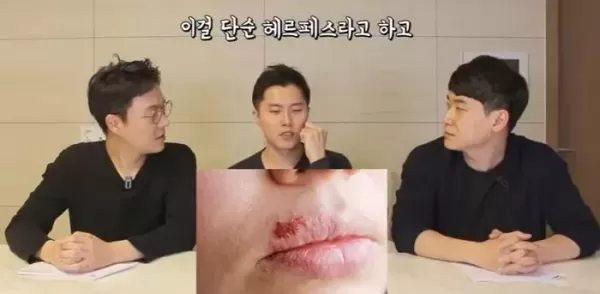 전 세계 38억명 감염시키고 완치도 안 되던 헤르페스 1형 바이러스, 치료길 열려