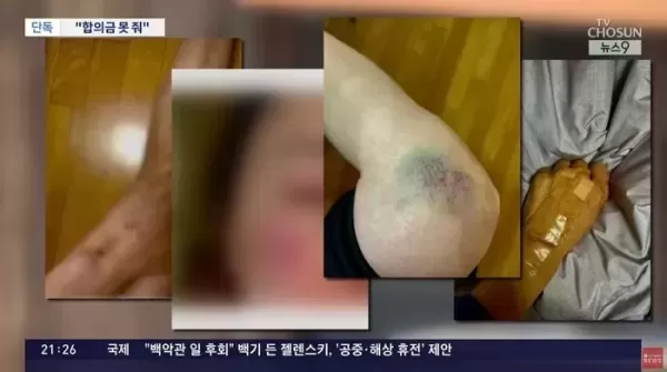 갑자기 쓰러진 식당 통창에 깔린 여성... 합의금 380만원 거부한 업주, TV 나온 스타세프였다