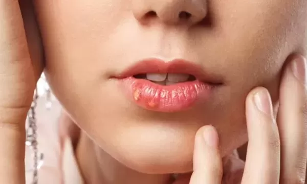 입술 보더니 너 성병이지? 몰아간 절친 손절했습니다