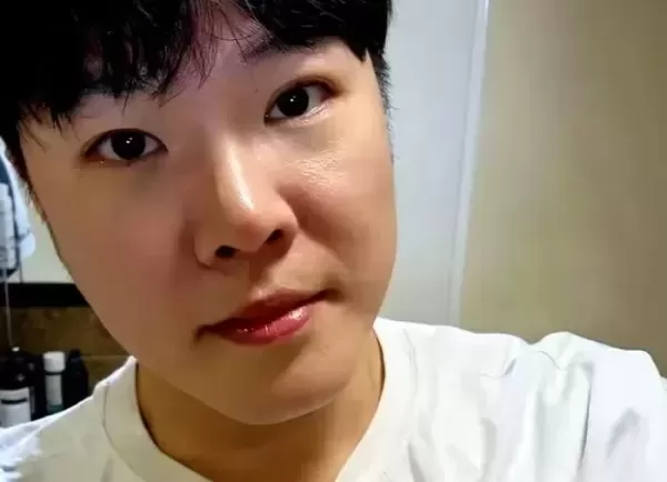프로포폴 상습 투약 휘성, 건강이상설 이후 확 달라진 근황 공개